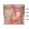 Examinari ale tractului digestiv superior