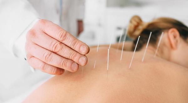 Beneficiile acupuncturii Beneficiile acupuncturii