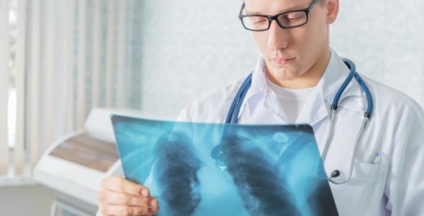 Aspergiloza: simptome, cauze si tratament Aspergiloza: simptome, cauze si tratament