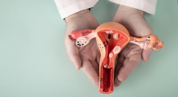 Mituri despre endometrioza Mituri despre endometrioza