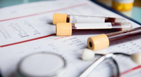 Sindromul Li-Fraumeni si riscul de cancer Sindromul Li-Fraumeni si riscul de cancer