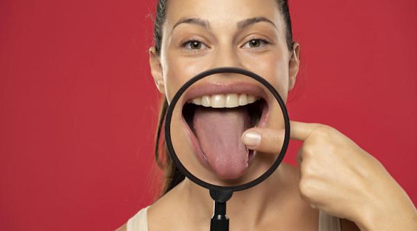 Macroglosia - cauze si tratament Macroglosia - cauze si tratament