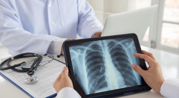 Screeningul pulmonar - instrument de diagnostic precoce al cancerului Screeningul pulmonar - instrument de diagnostic precoce al cancerului