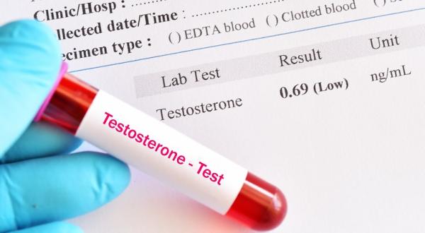 Scaderea testosteronului la femei - cauze si efecte Scaderea testosteronului la femei - cauze si efecte