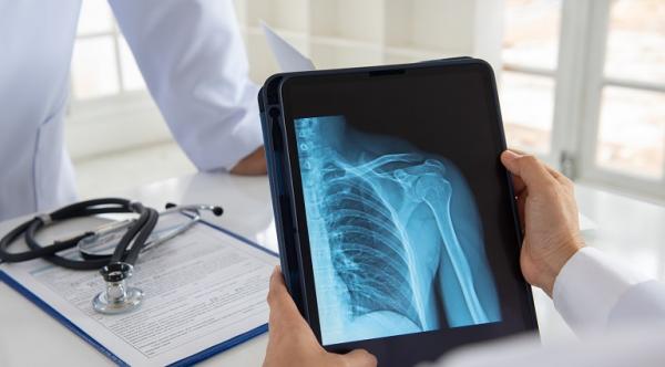 Contuzia pulmonara - evaluare si tratament Contuzia pulmonara - evaluare si tratament