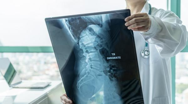 Diagnosticul si managementul tumorilor osoase benigne Diagnosticul si managementul tumorilor osoase benigne