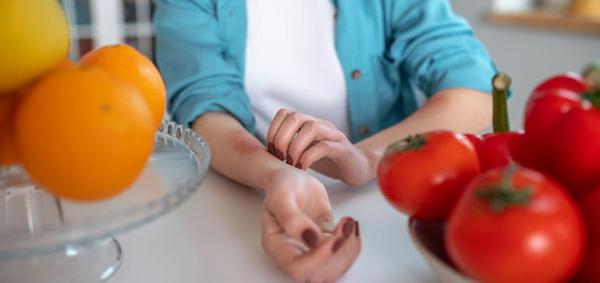 Alimente care pot declansa alergii cutanate Alimente care pot declansa alergii cutanate