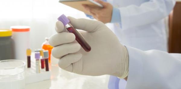 Analize de sange utilizate in patologia hepatica Analize de sange utilizate in patologia hepatica