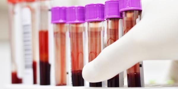 Analize medicale pe care trebuie sa le faci anual Analize medicale pe care trebuie sa le faci anual