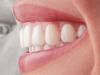 aparat_dentar_orto.jpg