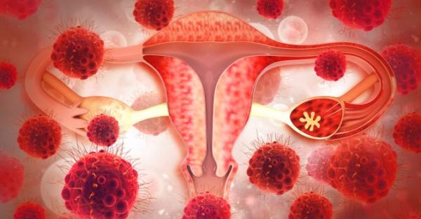Dr. Eugen CANE, medic primar obstetrica-ginecologie, ne vorbeste despre cancerul de col uterin si rezultatele PAP Dr. Eugen CANE, medic primar obstetrica-ginecologie, ne vorbeste despre cancerul de col uterin si rezultatele PAP