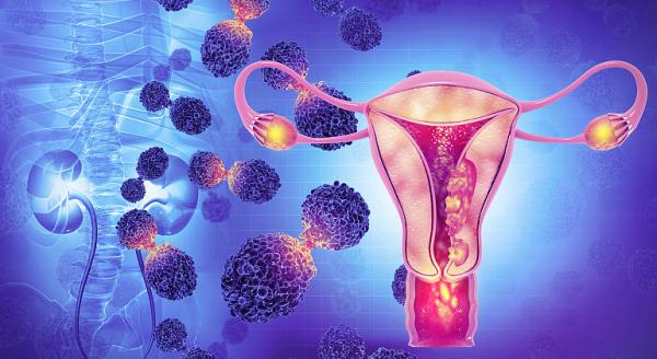 Cancerul endometrial Cancerul endometrial