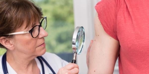 Poti fi expus riscului de a dezvolta cancer de piele? Poti fi expus riscului de a dezvolta cancer de piele?