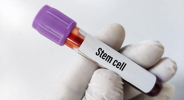 Intrebari esentiale pe care sa i le adresezi medicului despre celulele stem Intrebari esentiale pe care sa i le adresezi medicului despre celulele stem