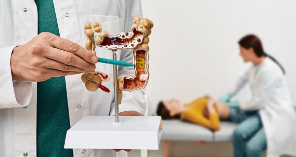 Cancerul de colon: de ce apare, factori de risc, simptome si tratament Cancerul de colon: de ce apare, factori de risc, simptome si tratament