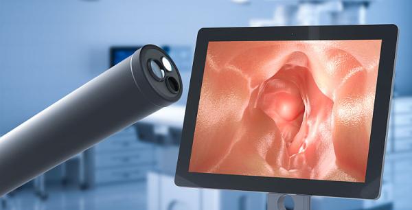 Corpii straini gastrointestinali Corpii straini gastrointestinali
