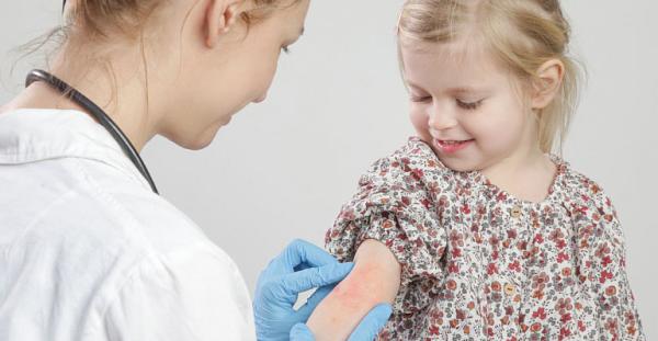 Dermatita atopica la copil Dermatita atopica la copil