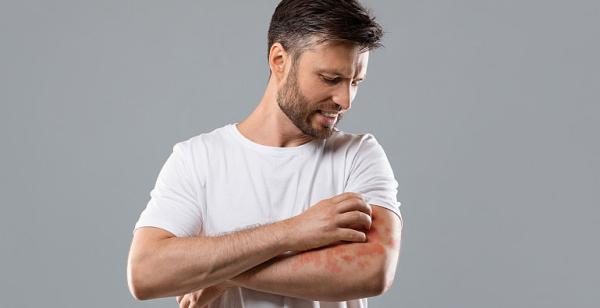 Dezinfectantii pot duce la dermatite de contact sau alte afectiuni ale pielii? Dezinfectantii pot duce la dermatite de contact sau alte afectiuni ale pielii?