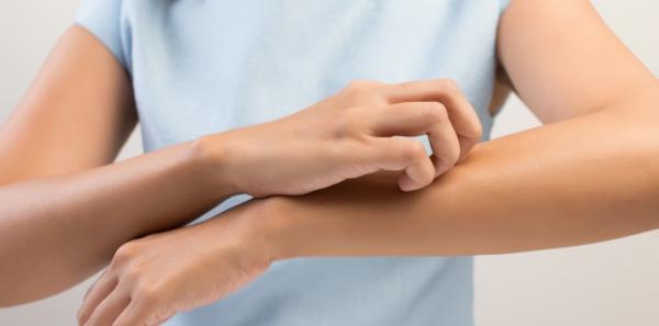 Factori care influenteaza aparitia eczemelor Factori care influenteaza aparitia eczemelor
