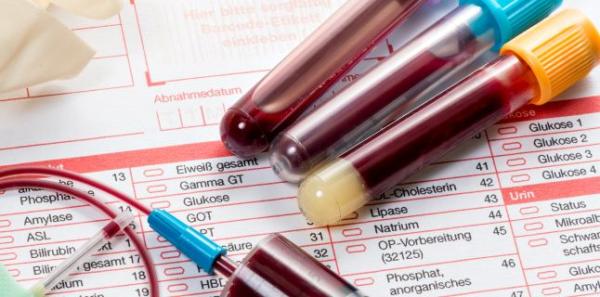 Ce poate indica nivelul crescut al enzimelor hepatice? Ce poate indica nivelul crescut al enzimelor hepatice?