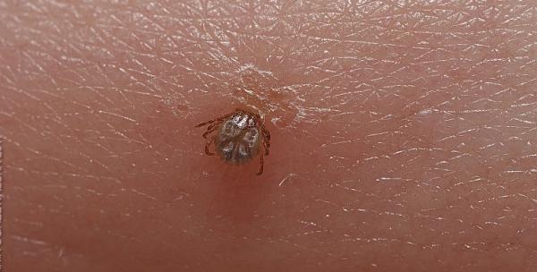 Febra patata a Muntilor Stancosi cauzata de muscatura de capusa Febra patata a Muntilor Stancosi cauzata de muscatura de capusa