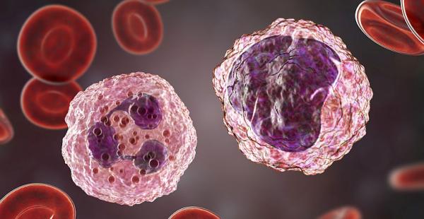 Semnele si simptomele generale intalnite in fibromatoza Semnele si simptomele generale intalnite in fibromatoza