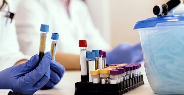 Hematocritul si implicatiile lui Hematocritul si implicatiile lui