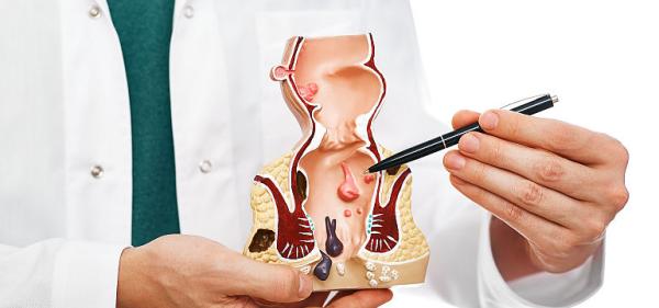 Hemoroizii – o problema tot mai des intalnita, interviu cu dr. Stefan Jianu medic Asociatia Medicilor Independenti Hemoroizii – o problema tot mai des intalnita, interviu cu dr. Stefan Jianu medic Asociatia Medicilor Independenti