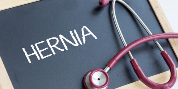 Tot ce trebuie sa stim despre hernia dupa nasterea prin cezariana Tot ce trebuie sa stim despre hernia dupa nasterea prin cezariana