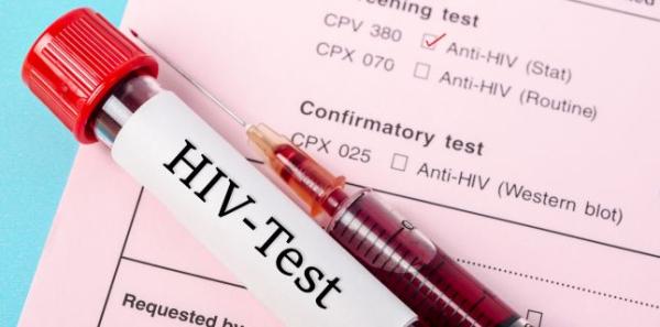 Simptomele de HIV si SIDA la femei Simptomele de HIV si SIDA la femei