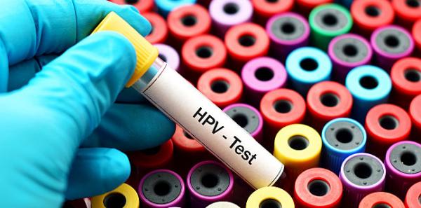 Infectia cu HPV: simptome, cauze, investigatii si tratament Infectia cu HPV: simptome, cauze, investigatii si tratament