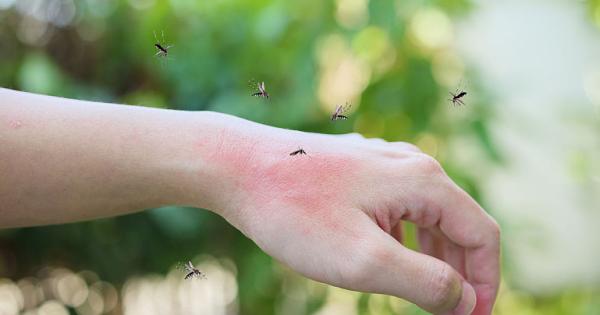 Virusul West Nile: simptome si tratament Virusul West Nile: simptome si tratament