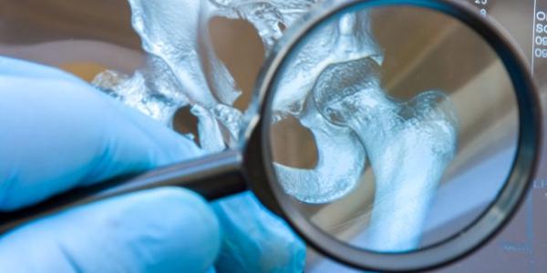 Investigatii medicale ale sistemului osos si articular Investigatii medicale ale sistemului osos si articular