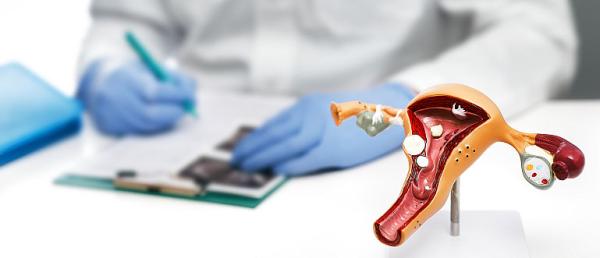 Legarea trompelor uterine - riscuri si beneficii Legarea trompelor uterine - riscuri si beneficii