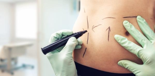 Liposuctia: riscuri si beneficii Liposuctia: riscuri si beneficii