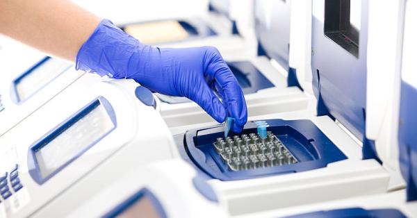 MedLife a identificat 46 de cazuri noi de infectare cu subvarianta BA.2 in urma procesului de secventiere a 171 de probe MedLife a identificat 46 de cazuri noi de infectare cu subvarianta BA.2 in urma procesului de secventiere a 171 de probe