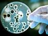 microb_rezistent_la_antibiotice.jpg