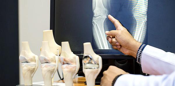 Osteoporoza Osteoporoza