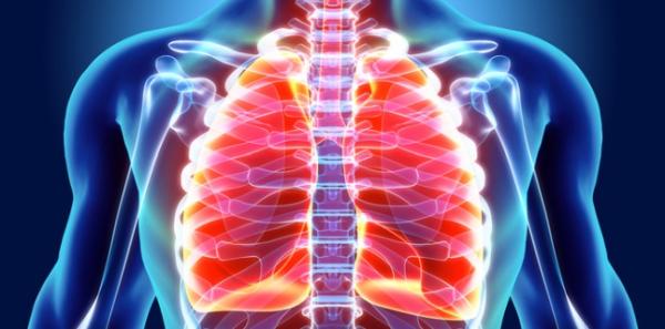 Cum se poate ajunge la plaman perforat (pneumotorax)? Cum se poate ajunge la plaman perforat (pneumotorax)?