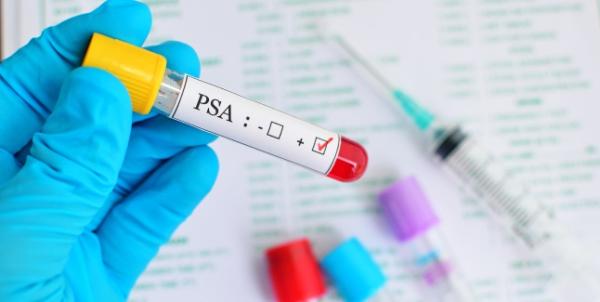 PSA liber si depistarea cancerului de prostata PSA liber si depistarea cancerului de prostata