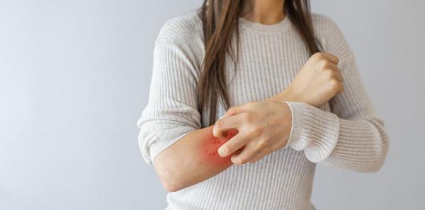 Psoriazis: informatii esentiale pe care trebuie sa le cunoasca un pacient diagnosticat cu psoriazis Psoriazis: informatii esentiale pe care trebuie sa le cunoasca un pacient diagnosticat cu psoriazis