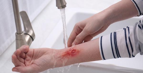 Te poti infecta in urma unei intepaturi/taieturi? Te poti infecta in urma unei intepaturi/taieturi?