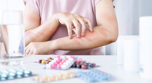 Alergiile la medicamente Alergiile la medicamente