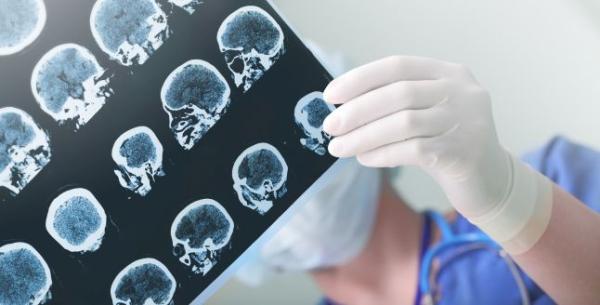 Lucruri pe care ar trebui sa le stii inainte de a face un RMN cerebral Lucruri pe care ar trebui sa le stii inainte de a face un RMN cerebral