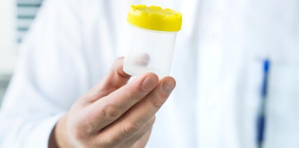 Spermograma: utilizari, procedura si rezultate Spermograma: utilizari, procedura si rezultate