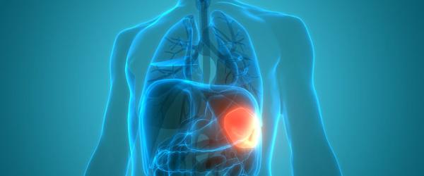 Splenomegalia sau marirea splinei - cauze, simptome, tratament Splenomegalia sau marirea splinei - cauze, simptome, tratament