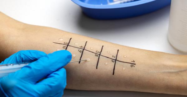 Alergia poate aparea la orice varsta. Iata cei mai frecventi alergeni Alergia poate aparea la orice varsta. Iata cei mai frecventi alergeni