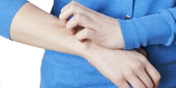 Urticaria - o afectiune ce nu trebuie trecuta cu vederea Urticaria - o afectiune ce nu trebuie trecuta cu vederea