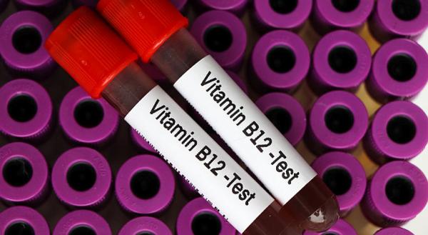 Anemia prin deficit de vitamina B12 (Anemia pernicioasa) Anemia prin deficit de vitamina B12 (Anemia pernicioasa)