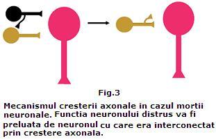 moartea neuronala